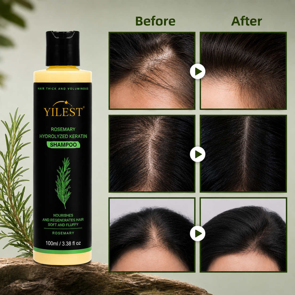 YILEST Rosemary Hair Growth Shampoo Reduce Hair Fall & Support Fuller-Looking Hair Naturally