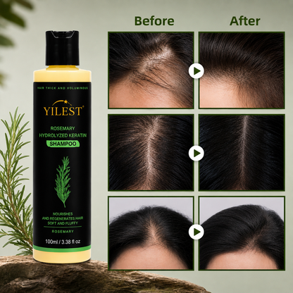 YILEST Rosemary Hair Growth Shampoo Reduce Hair Fall & Support Fuller-Looking Hair Naturally