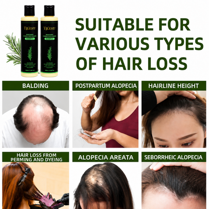YILEST Rosemary Hair Growth Shampoo Reduce Hair Fall & Support Fuller-Looking Hair Naturally